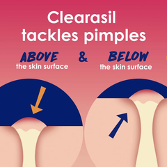 Clearasil Rapid Rescue Deep Treatment Pads - 90ct